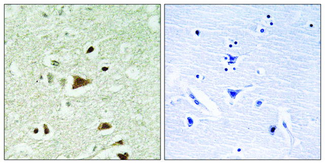 Anti-SMAD2 antibody produced in rabbit affinity isolated antibody