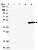 Anti-ULK3 antibody produced in rabbit Prestige Antibodies® Powered by Atlas Antibodies, affinity isolated antibody, buffered aqueous glycerol solution