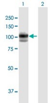 Anti-GAA antibody produced in mouse purified immunoglobulin, buffered aqueous solution