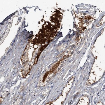 Anti-PRSS8 antibody produced in rabbit Prestige Antibodies&#174; Powered by Atlas Antibodies, affinity isolated antibody, buffered aqueous glycerol solution