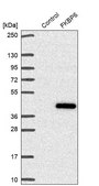 Anti-FKBP6 antibody produced in rabbit Prestige Antibodies® Powered by Atlas Antibodies, affinity isolated antibody, buffered aqueous glycerol solution