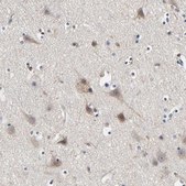 Anti-LRP1 antibody produced in rabbit Prestige Antibodies® Powered by Atlas Antibodies, affinity isolated antibody, buffered aqueous glycerol solution