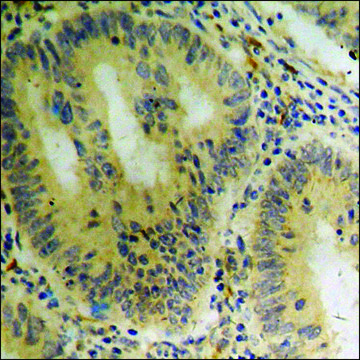 Anti-phospho-ASK1 (pSer966) antibody produced in rabbit affinity isolated antibody