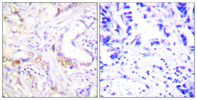 Anti-PIAS3 antibody produced in rabbit affinity isolated antibody