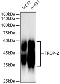 Anti-TROP-2 Antibody, clone 7X3Q2, Rabbit Monoclonal