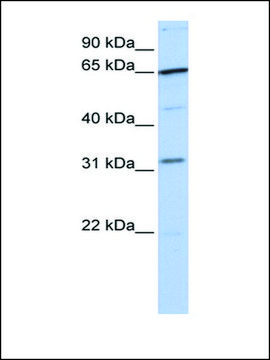 Anti-SRPR antibody produced in rabbit affinity isolated antibody