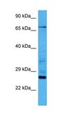 Anti-MSLN antibody produced in rabbit affinity isolated antibody