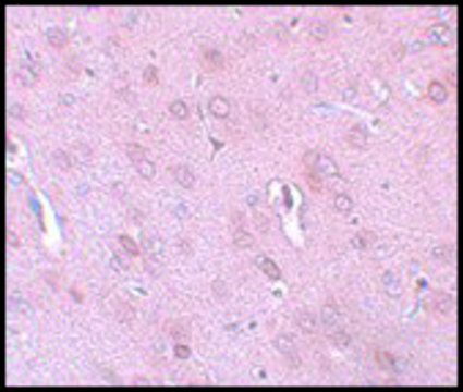 Anti-TRESK antibody produced in rabbit affinity isolated antibody, buffered aqueous solution