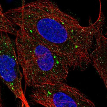 Anti-SCARB1 antibody produced in rabbit Prestige Antibodies&#174; Powered by Atlas Antibodies, affinity isolated antibody, buffered aqueous glycerol solution