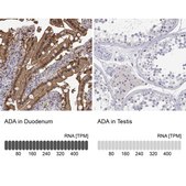 Anti-ADA antibody produced in rabbit Prestige Antibodies® Powered by Atlas Antibodies, affinity isolated antibody, buffered aqueous glycerol solution