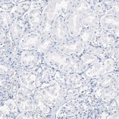 Monoclonal Anti-AGER antibody produced in mouse Prestige Antibodies® Powered by Atlas Antibodies, clone CL10591, purified antibody (Protein A)