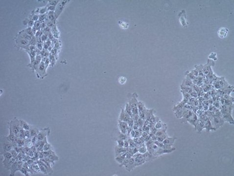 UM-SCC-17A Squamous Carcinoma Cell Line UM-SCC-17A is a unique head and neck squamous carcinoma cell line isolated from the primary laryngeal carcinoma of a 48-year old female patient who failed to respond to radiation therapy and is a suitable in vitro model of H&amp;N carcinoma studies.