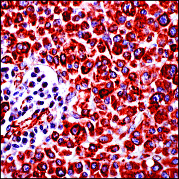 Anti-Vimentin antibody, Rabbit monoclonal clone SP20, recombinant, expressed in proprietary host, tissue culture supernatant