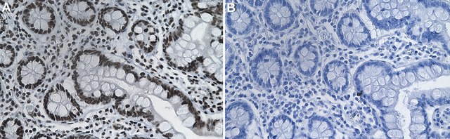 Anti-TRIM28/KAP-1 Antibody, clone 1G5 ZooMAb&#174; Rabbit Monoclonal recombinant, expressed in HEK 293 cells