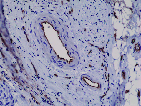 Anti-CD31 (PECAM-1) antibody, Rabbit monoclonal clone RM247, recombinant, expressed in HEK 293 cells, purified immunoglobulin