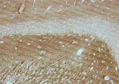 抗Tau-1抗体，克隆PC1C6 clone PC1C6, Chemicon&#174;, from mouse