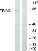 Anti-TRIM3 antibody produced in rabbit affinity isolated antibody
