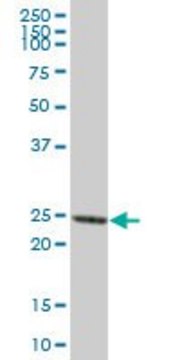 Anti-PRTN3 antibody produced in mouse purified immunoglobulin, buffered aqueous solution