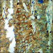 Anti-phospho-Catenin-β (pThr41/Ser45) antibody produced in rabbit affinity isolated antibody
