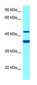 Anti-SCD5 (C-terminal) antibody produced in rabbit affinity isolated antibody