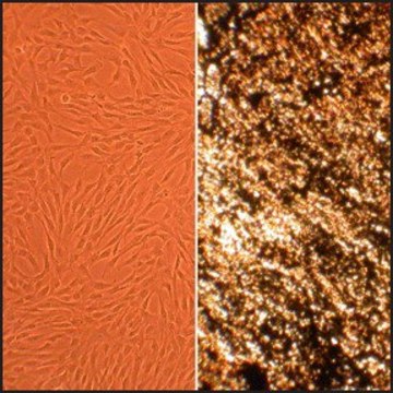 Human Osteoblasts: HOb, fetal