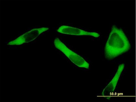 Anti-RARS antibody produced in mouse purified immunoglobulin, buffered aqueous solution