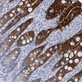 Anti-RBP2 antibody produced in rabbit Prestige Antibodies® Powered by Atlas Antibodies, affinity isolated antibody, buffered aqueous glycerol solution
