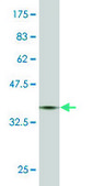 Monoclonal Anti-RIPK4, (C-terminal) antibody produced in mouse clone 2D1, purified immunoglobulin, buffered aqueous solution
