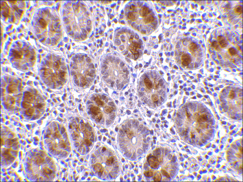 Anti-AATF antibody produced in rabbit affinity isolated antibody, buffered aqueous solution