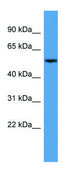 Anti-CYP3A5 (N-terminal) antibody produced in rabbit affinity isolated antibody