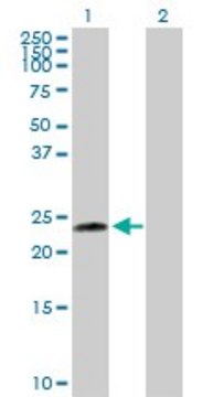 Anti-UBE2T antibody produced in rabbit purified immunoglobulin, buffered aqueous solution