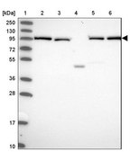 Anti-INO80D antibody produced in rabbit Prestige Antibodies® Powered by Atlas Antibodies, affinity isolated antibody, buffered aqueous glycerol solution