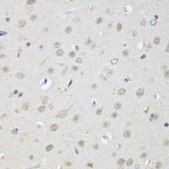 Anti-CTCF antibody produced in rabbit