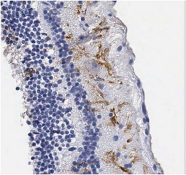 Anti-ARMS2 Antibody from rabbit, purified by affinity chromatography