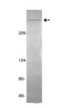 Anti-vWF (von Willebrand Factor) Antibody, clone GMA-022 clone GMA-022, Upstate&#174;, from mouse