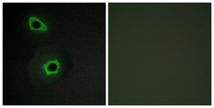 Anti-Collagen VII α1 antibody produced in rabbit affinity isolated antibody