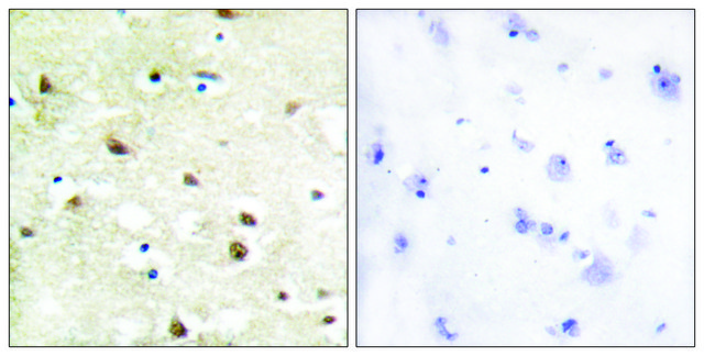 Anti-HNRNP C1 antibody produced in rabbit affinity isolated antibody