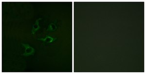Anti-CBL antibody produced in rabbit affinity isolated antibody