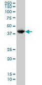 Monoclonal Anti-GLUL antibody produced in mouse clone 2B12, purified immunoglobulin, buffered aqueous solution