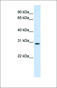 Anti-SLC25A20 antibody produced in rabbit affinity isolated antibody