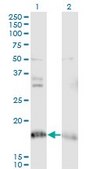 Monoclonal Anti-NDUFA8, (N-terminal) antibody produced in mouse clone 2E10, purified immunoglobulin, buffered aqueous solution
