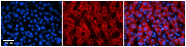 Anti-RARA antibody produced in rabbit affinity isolated antibody