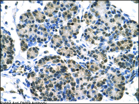 Anti-DHX9 antibody produced in rabbit affinity isolated antibody