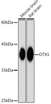 Anti-OTX1 Antibody, clone 6H7J9, Rabbit Monoclonal