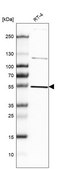 Anti-ST13 antibody produced in rabbit Prestige Antibodies® Powered by Atlas Antibodies, affinity isolated antibody, buffered aqueous glycerol solution