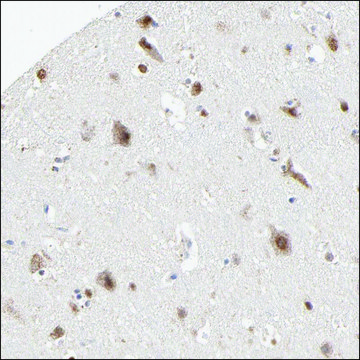 Anti-SDHB antibody produced in rabbit Ab1, Prestige Antibodies&#174; Powered by Atlas Antibodies, affinity isolated antibody, buffered aqueous glycerol solution