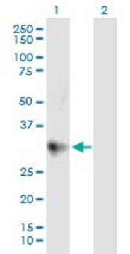 Anti-CTRC antibody produced in mouse purified immunoglobulin, buffered aqueous solution