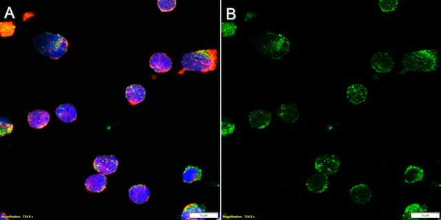 Anti-Properdin/CFP Antibody, clone 1K9 ZooMAb&#174; Rabbit Monoclonal recombinant, expressed in HEK 293 cells