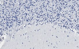 Anti-BTG2 Antibody, clone 1G17 ZooMAb® Rabbit Monoclonal recombinant, expressed in HEK 293 cells