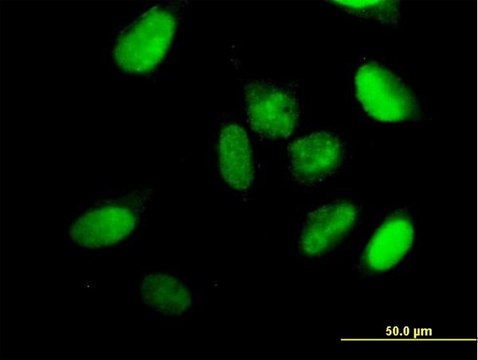 Anti-KIF22 antibody produced in mouse purified immunoglobulin, buffered aqueous solution